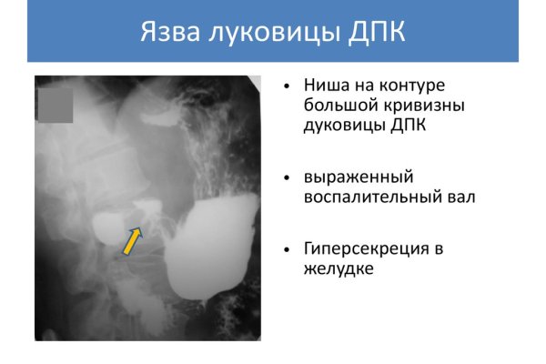 Что с кракеном сайт на сегодня